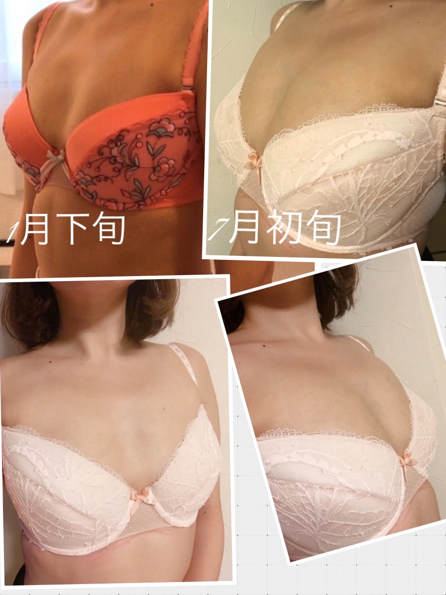 サプリでデコルテ劇的ビフォーアフター