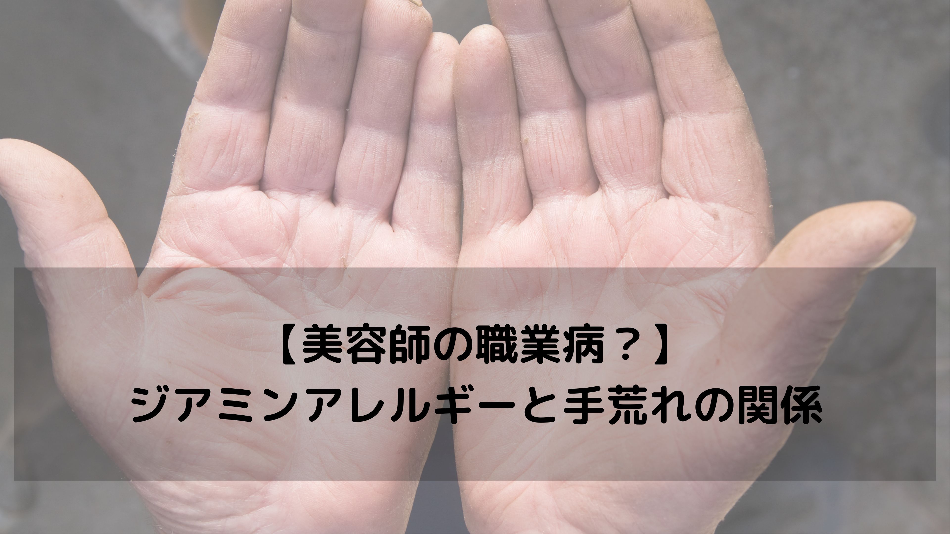 【美容師の“手荒れ”はジアミンが原因かも？】職業病にならないための対策と見直しポイント