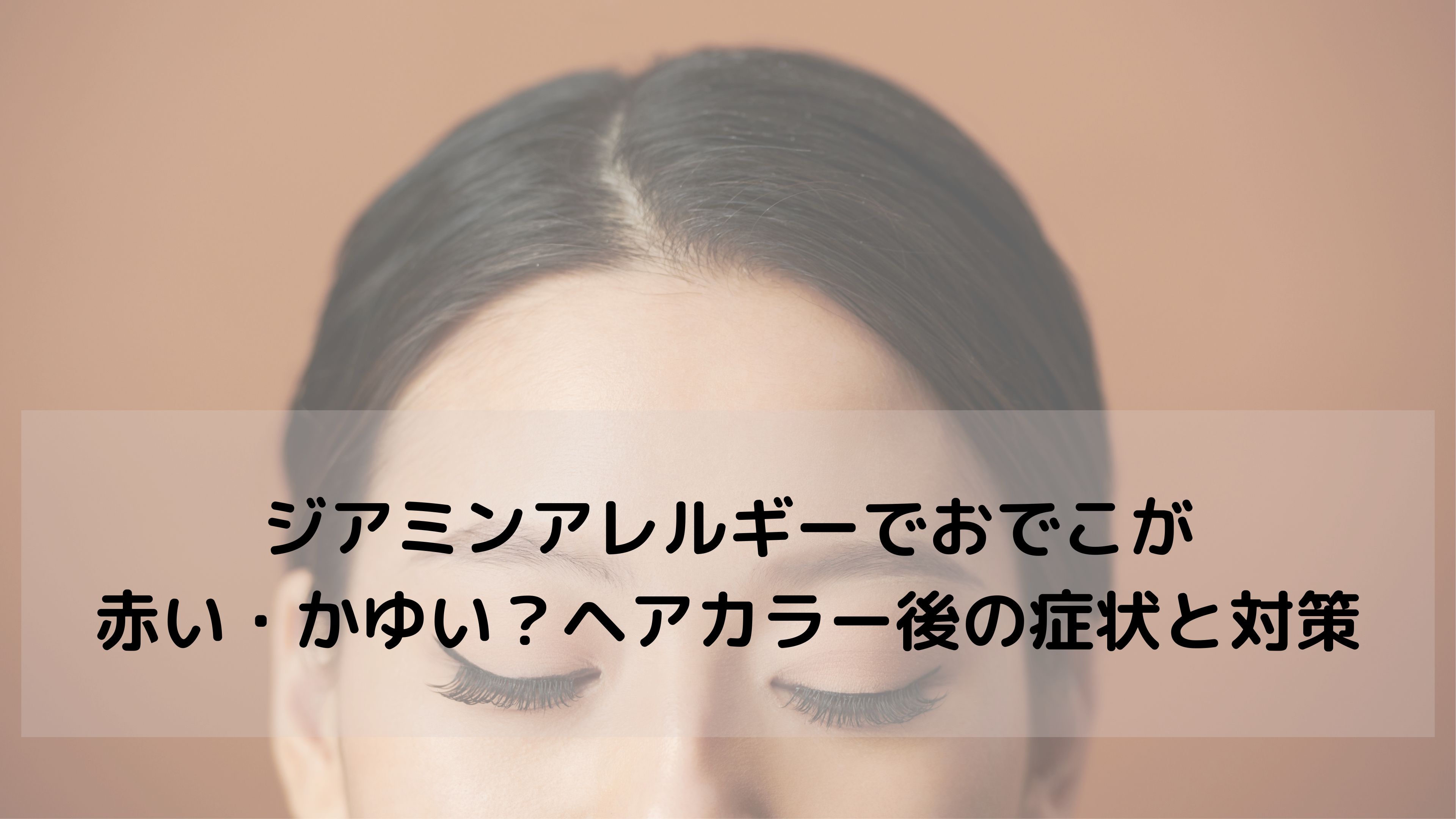 【おでこの赤み・かゆみ】それ、ジアミンアレルギーかもしれません｜症状と対策・代替アイテムを紹介