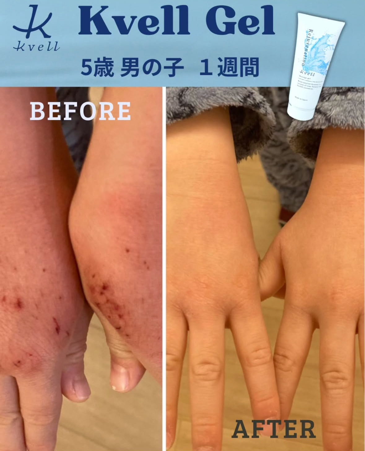【クベルナノジェル】塗るだけで肌に潤いを届けて、 皮脂や不要なものを包んで出す‼︎