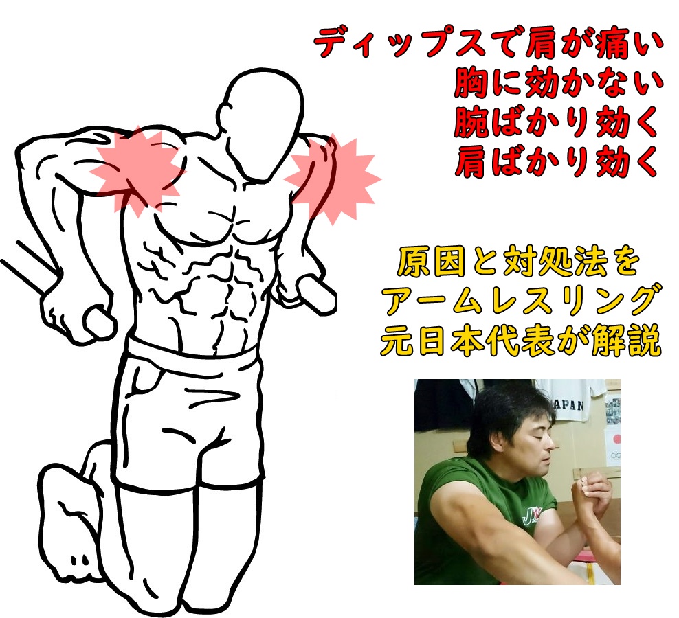ディップスで肩が痛い・胸に効かない・腕が疲れる｜原因と対処法をアームレスリング元日本代表が解説