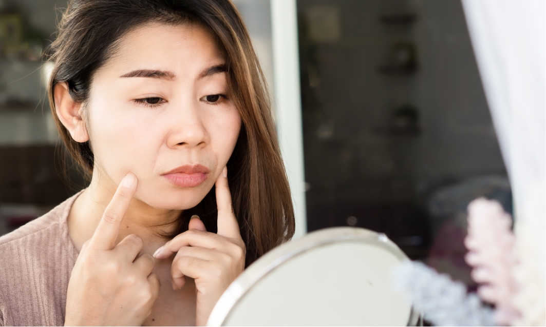 フェイスラインのもたつき解消!頭皮ケアで若々しい印象に