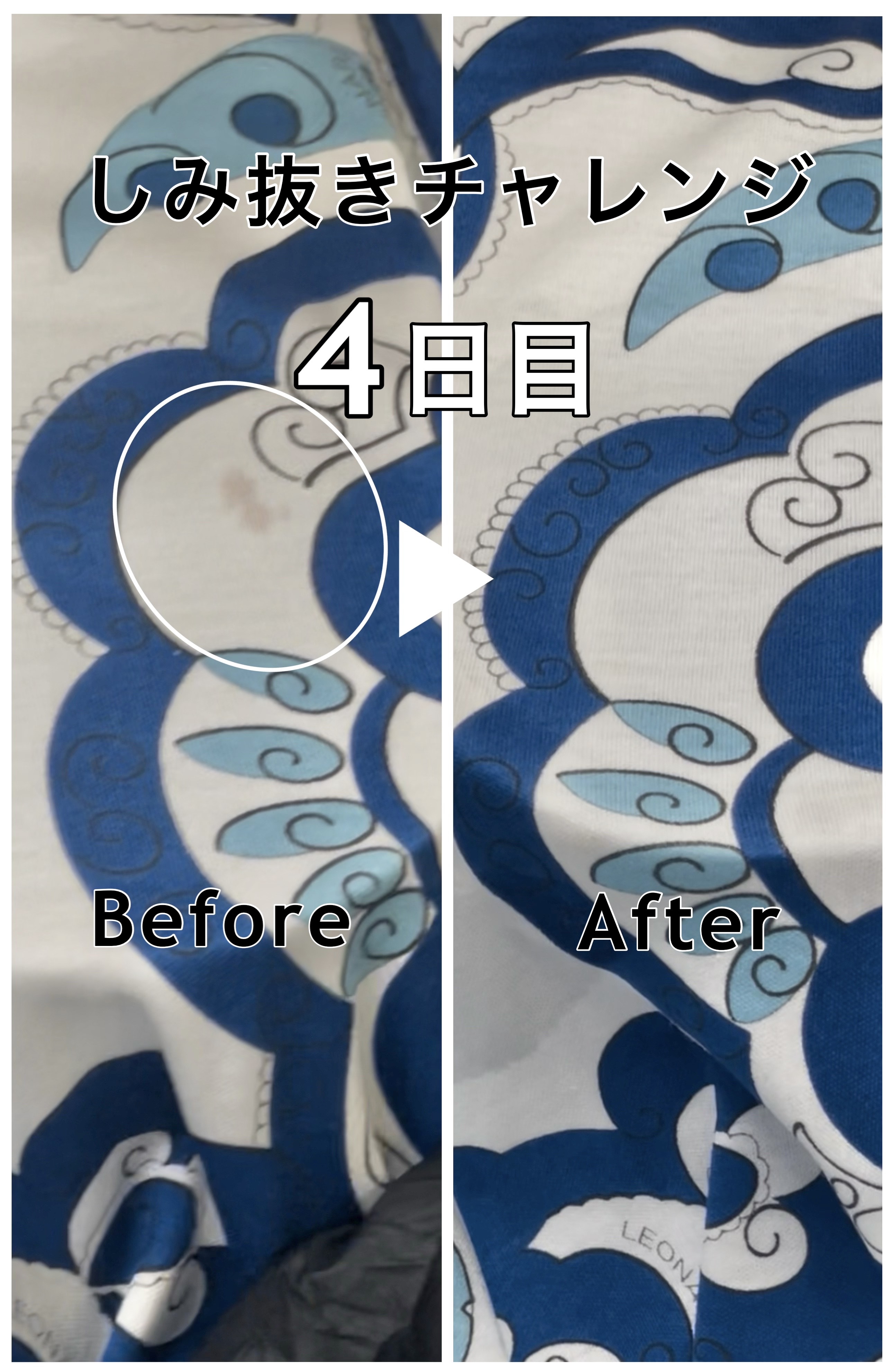 【しみ抜きチャレンジDay4】LEONARDブラウスのぶどうのしみ抜き — 美しさは慎重さの中に宿る