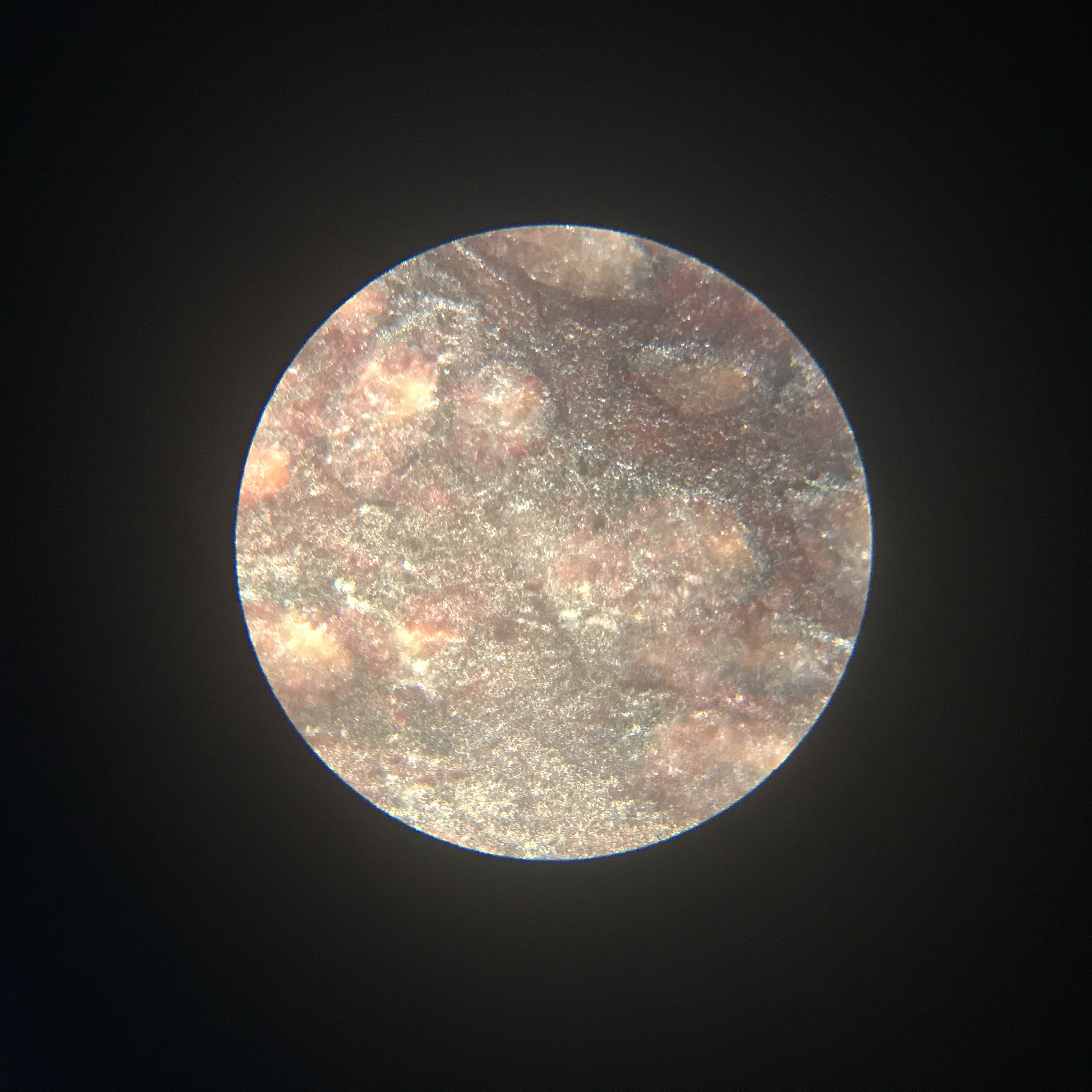 このmicroplanetsは？