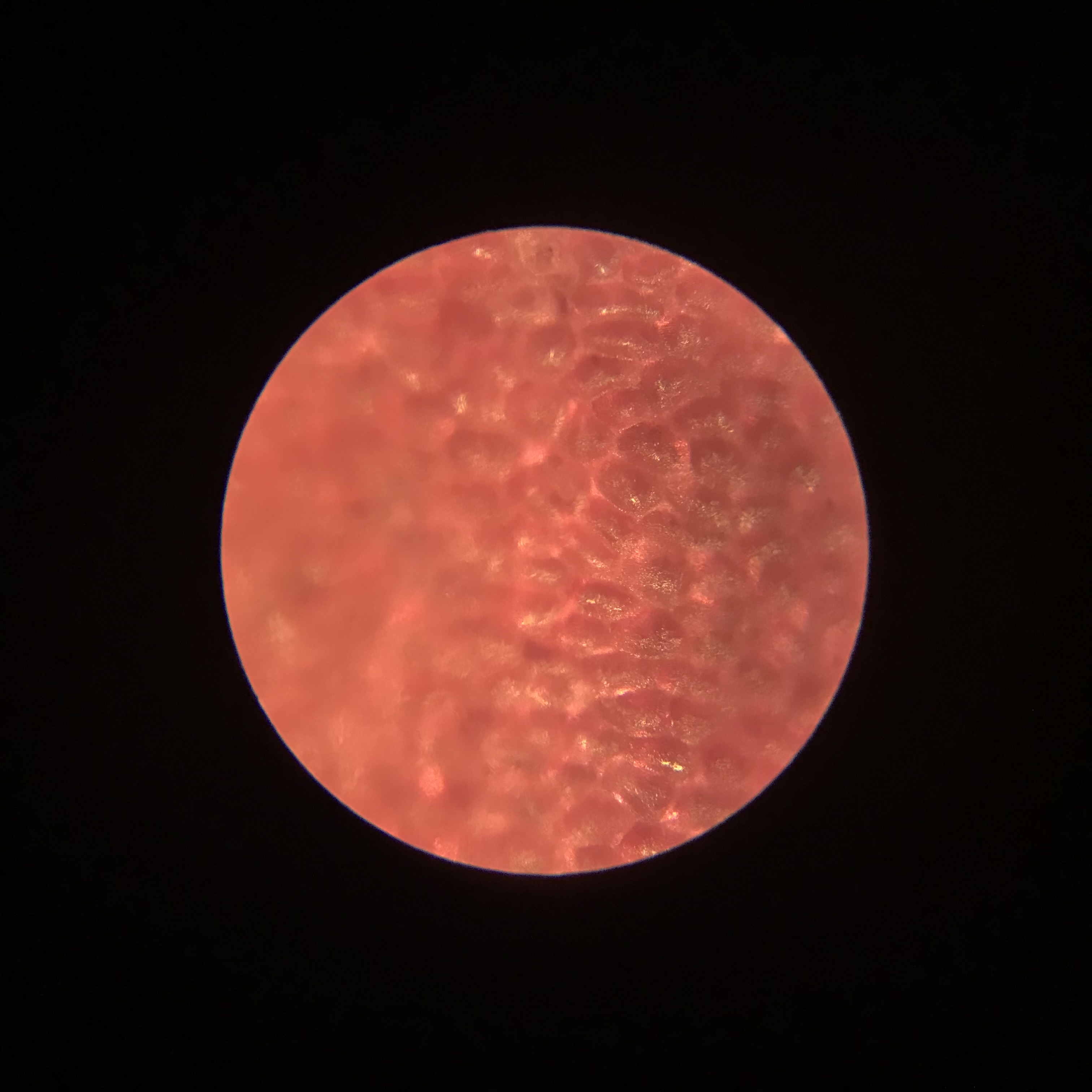 赤いmicroplanets