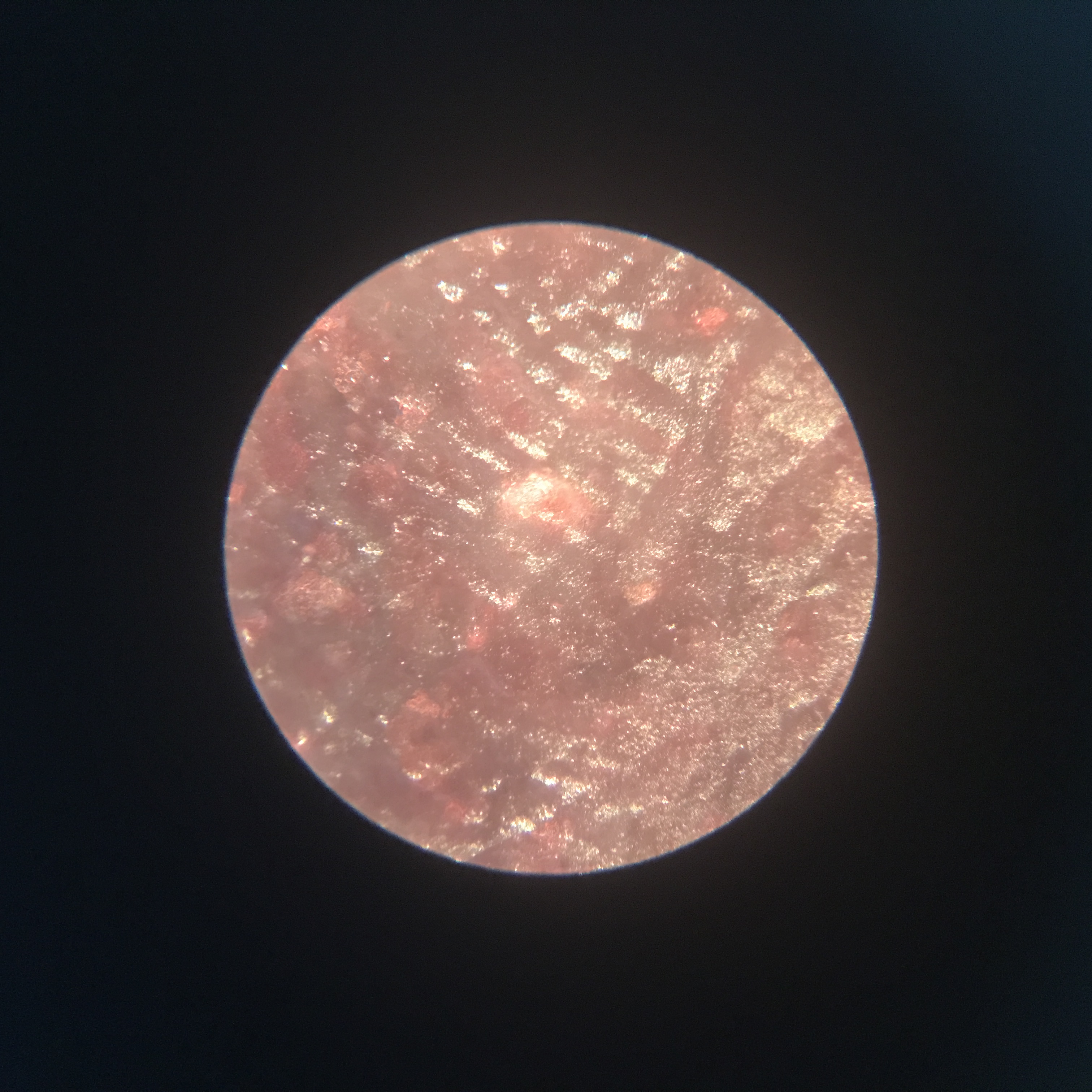 このmicroplanetsは？