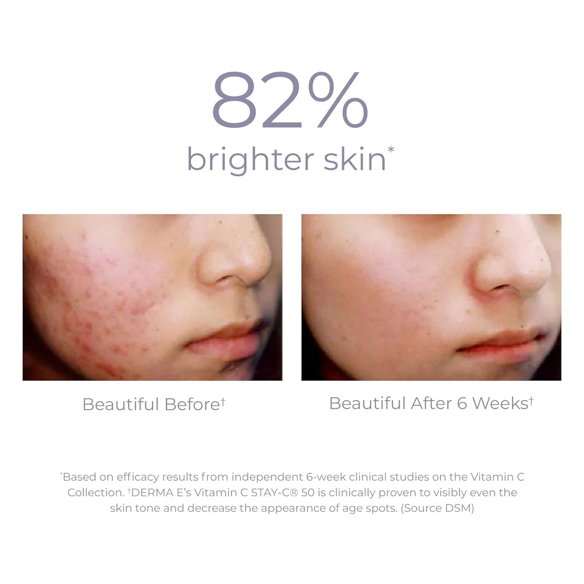 6月14日　DERMA E ビタミンCシリーズの販売をスタートします！