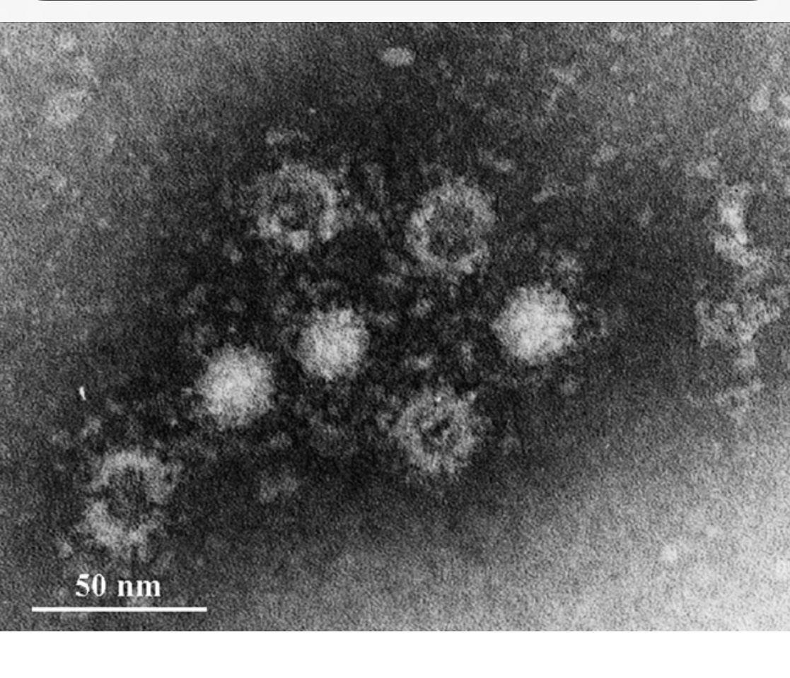 Ｅ型肝炎ウイルスについて　