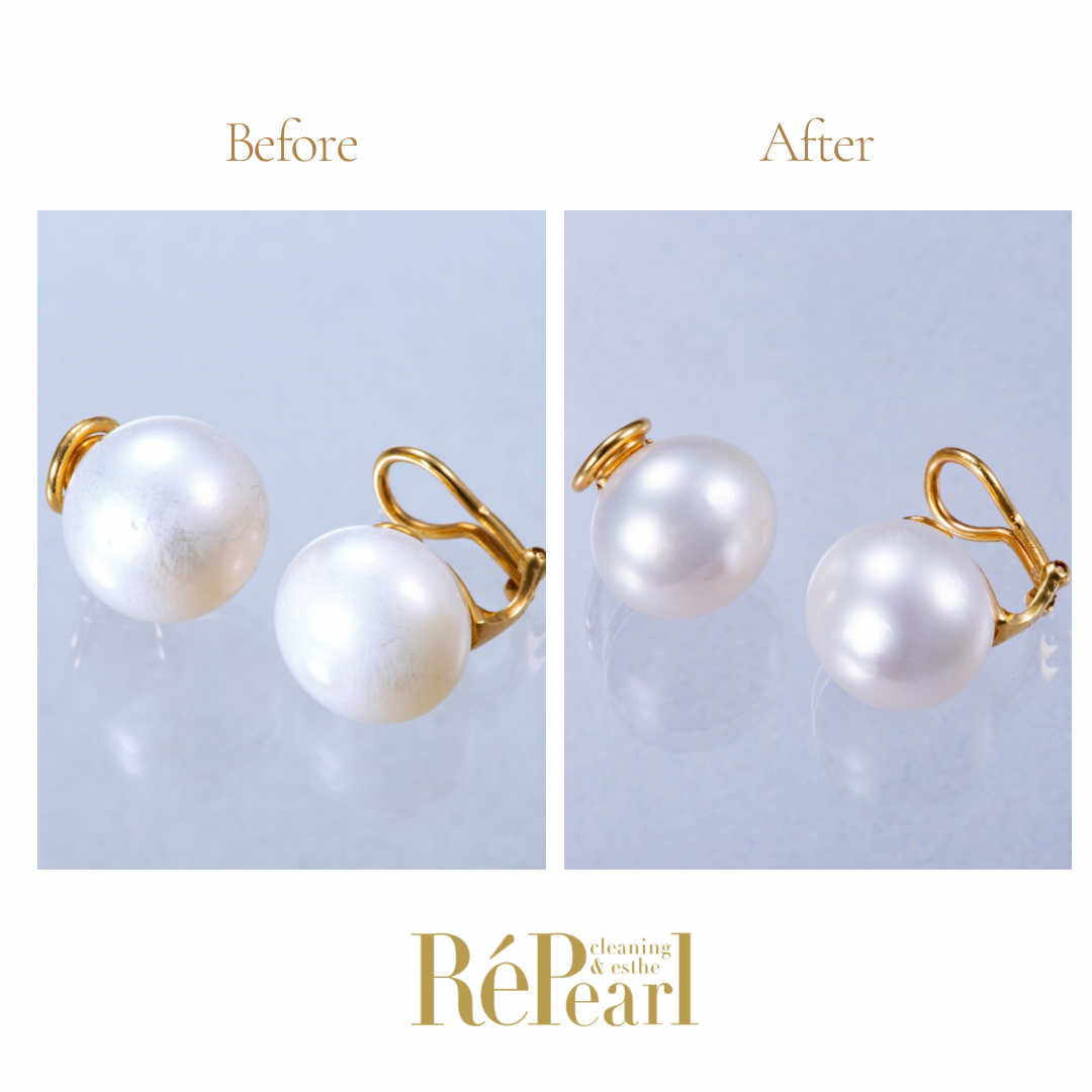 Repearl®︎ ▷▷▷Before After