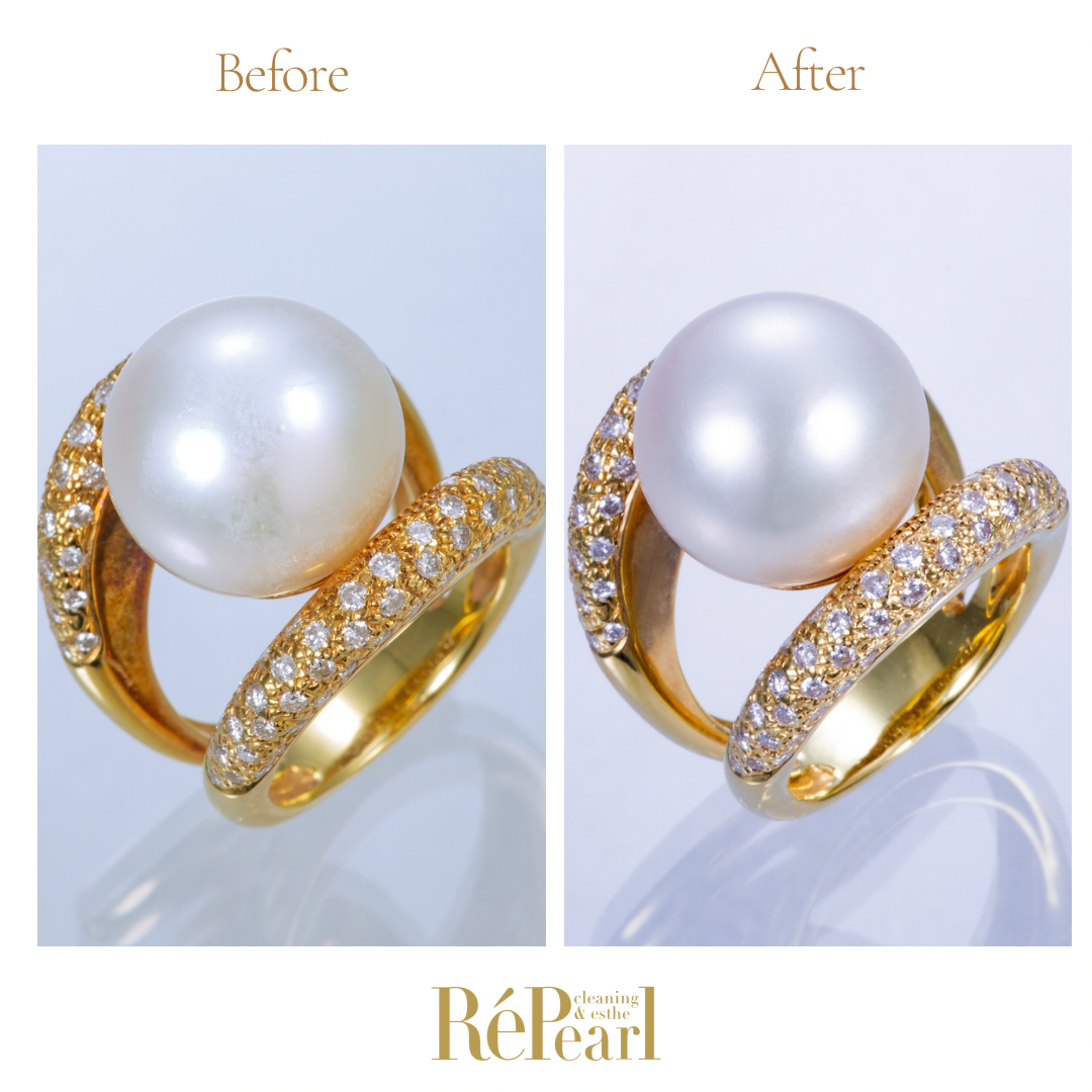 Repearl®︎ ▷▷▷Before After