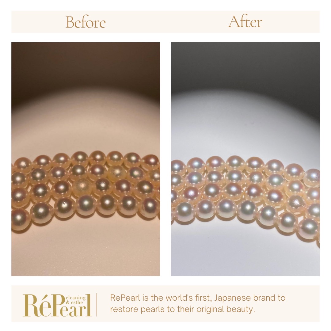 Repearl®︎ ▷▷▷Before After