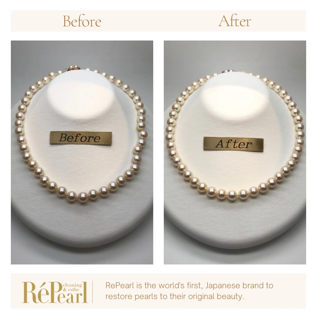 Repearl®︎ ▷▷▷Before After