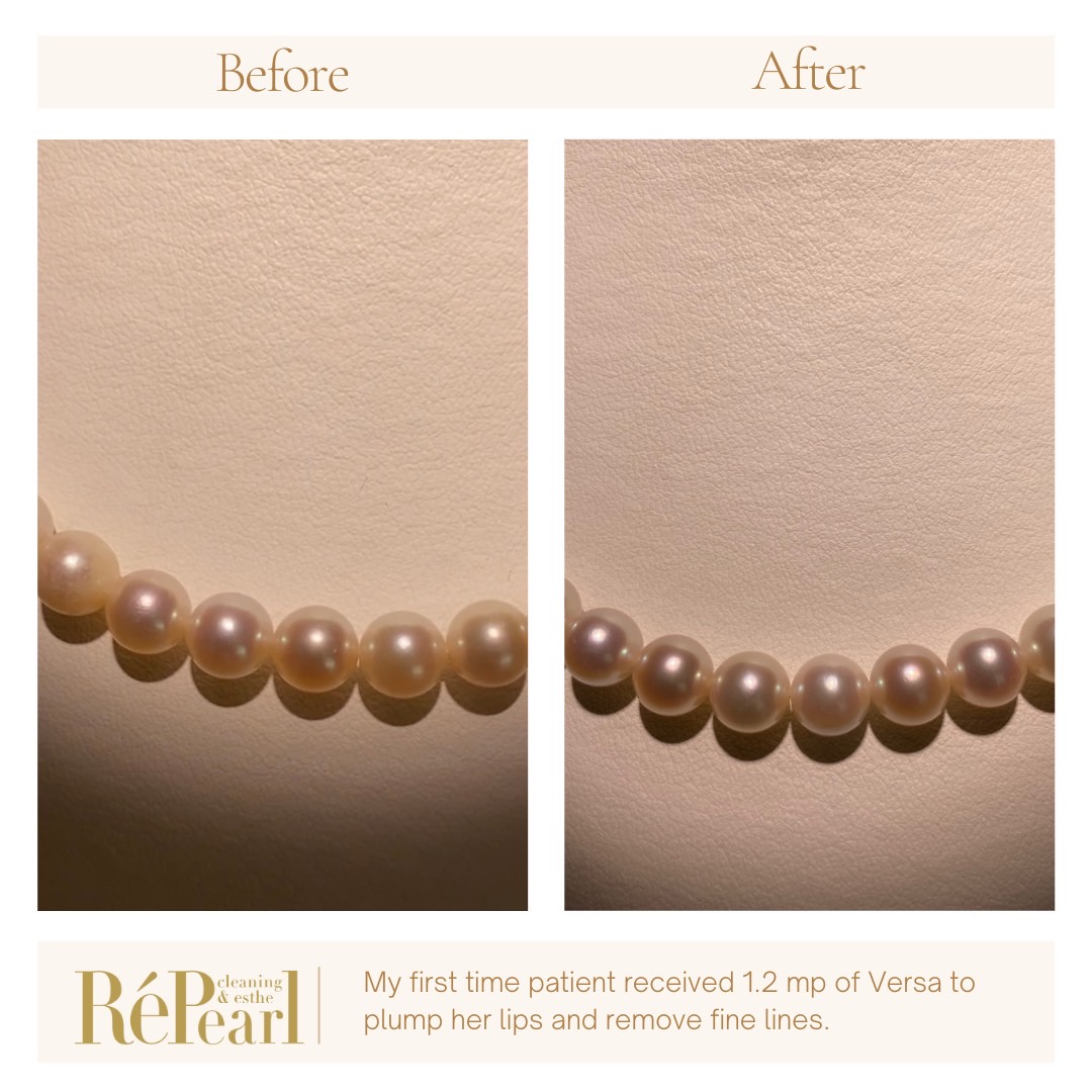 Repearl®︎ ▷▷▷Before After＆Customer's voice