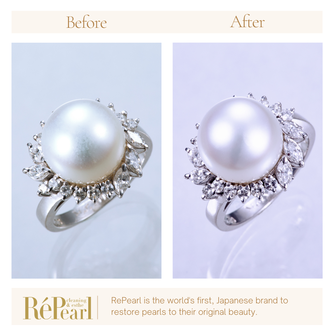 Repearl®︎ ▷▷▷Before After