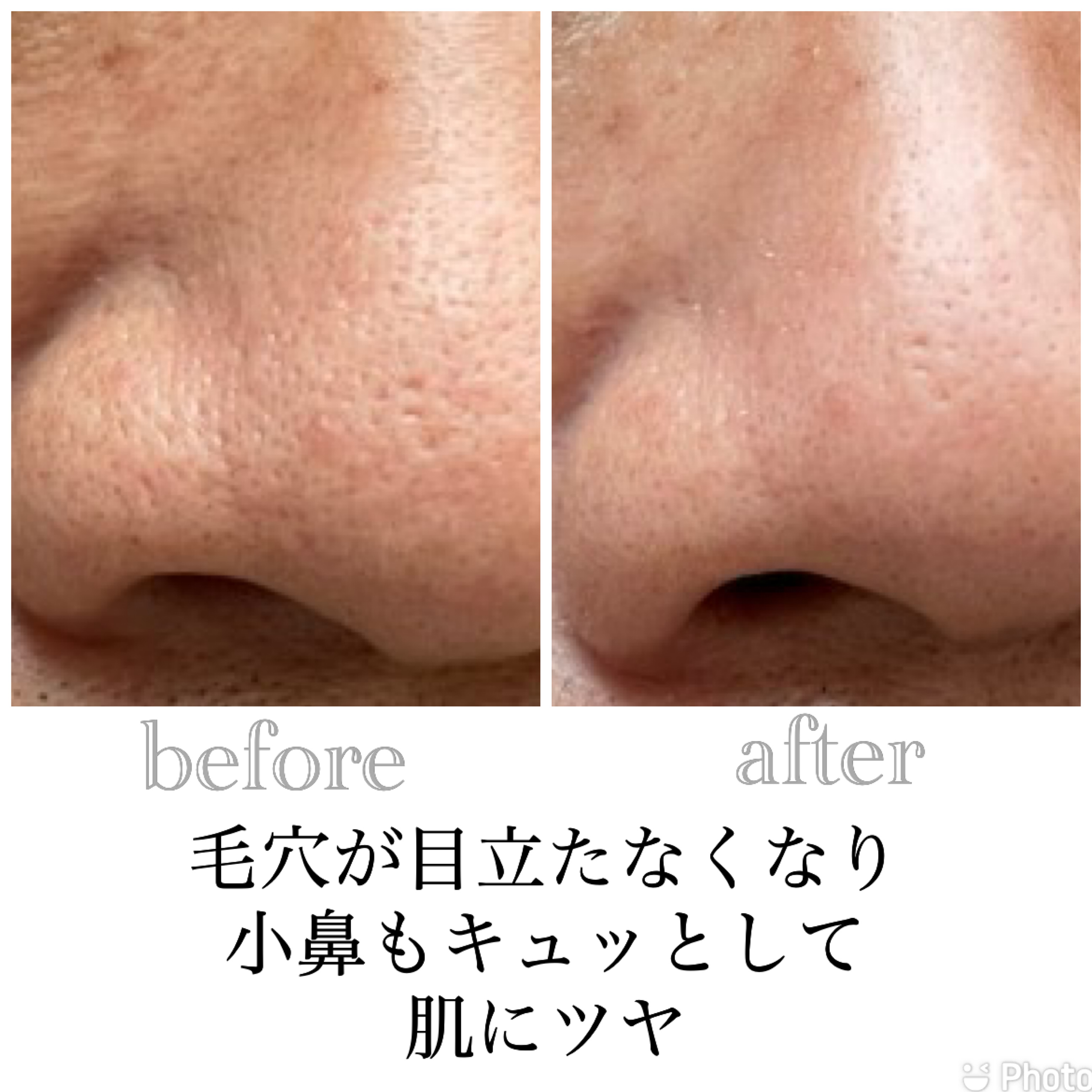 クレイパックで毛穴ケアしてリフトアップ✨