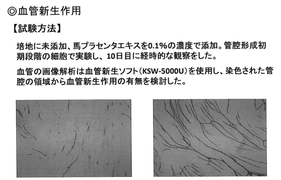 Platinum SBに関して