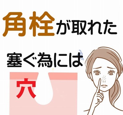 角栓が取れた後の「穴」の対策