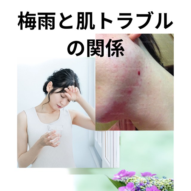 ニキビ・赤ら顔専門「こことみ」 ～cocotomi～