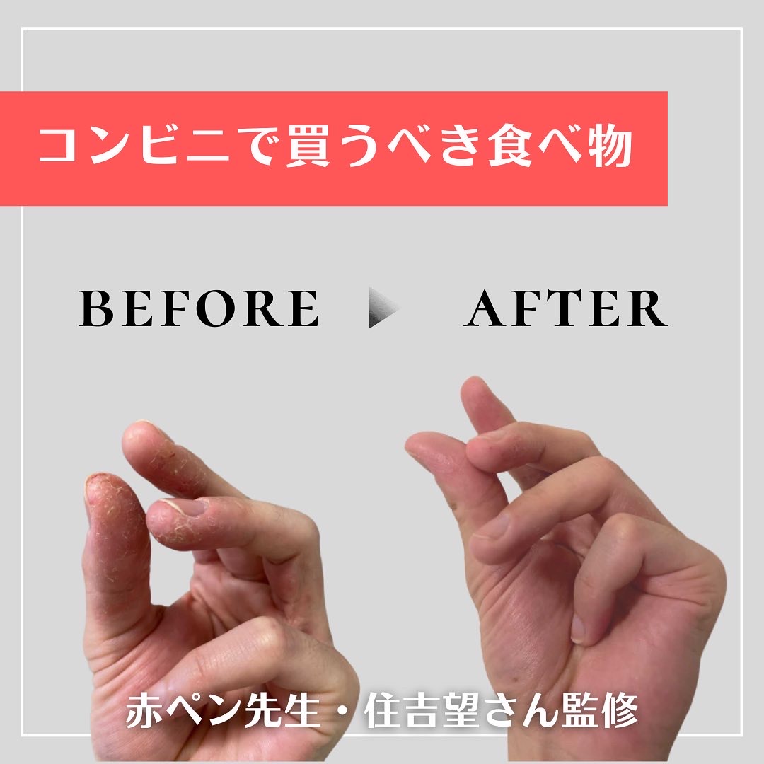 手あれに効く「コンビニで買うべき食べ物」