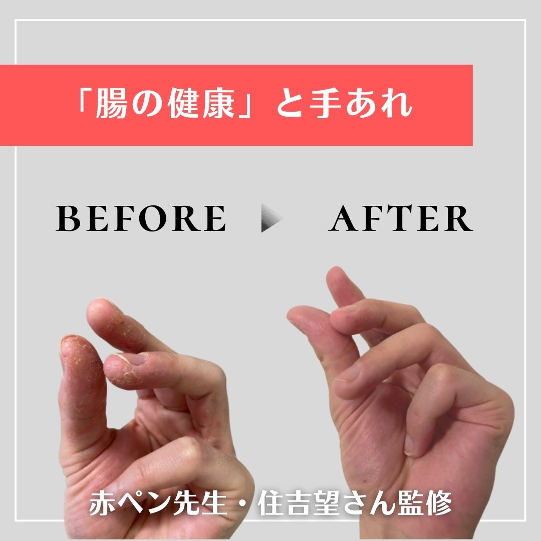 「健康な腸」を目指そう！