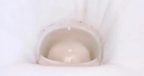 トイレのさぼったリングとは？