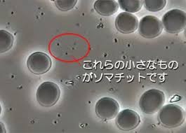 謎の生命体 ソマチットとシュガーケイ素