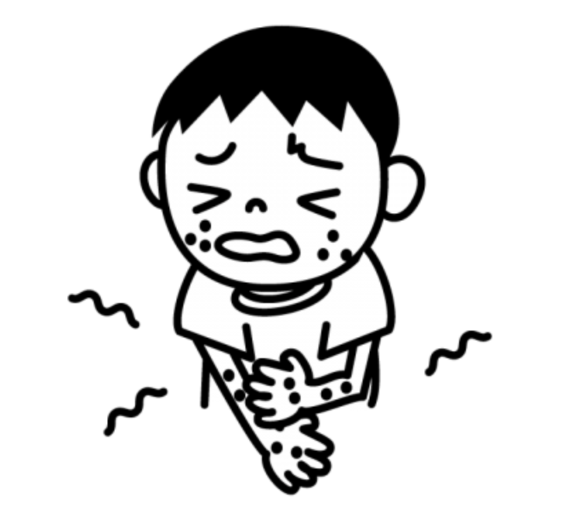 じんましんやアレルギー対策にはこれだ!!