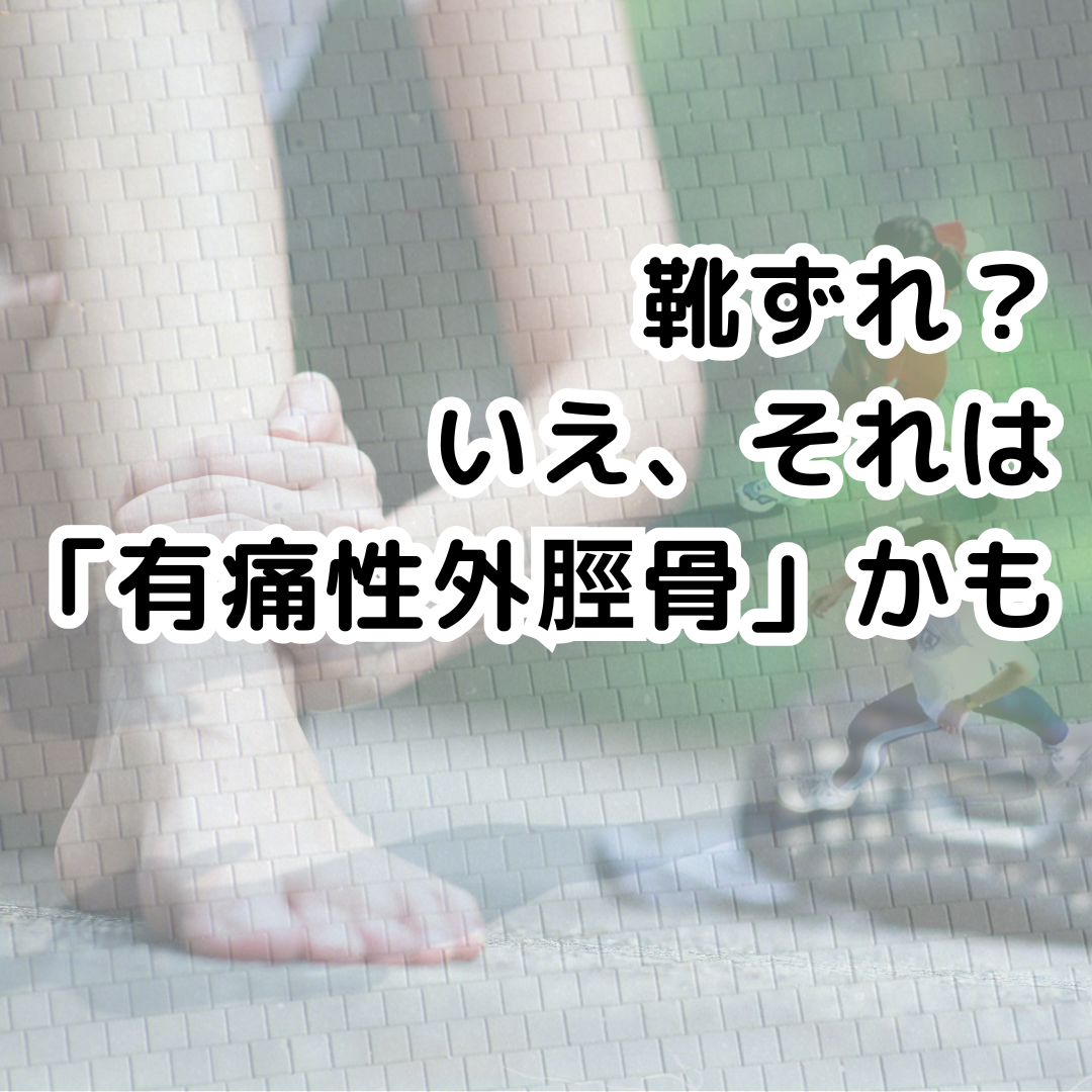 「この足の痛み、何だろう？」ランニングを楽しむあなたに知ってほしい「有痛性外脛骨」の真実👣