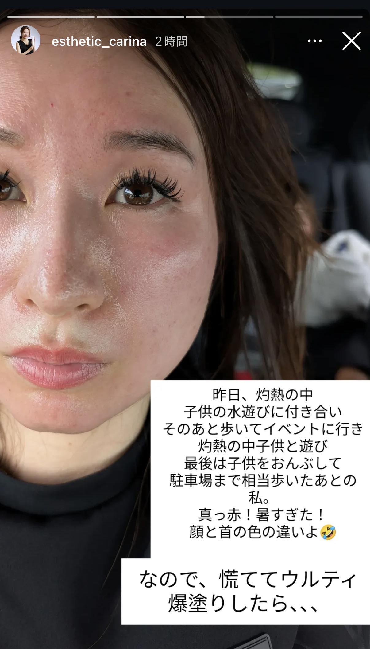 紫外線対策をウルティブライトで🩷