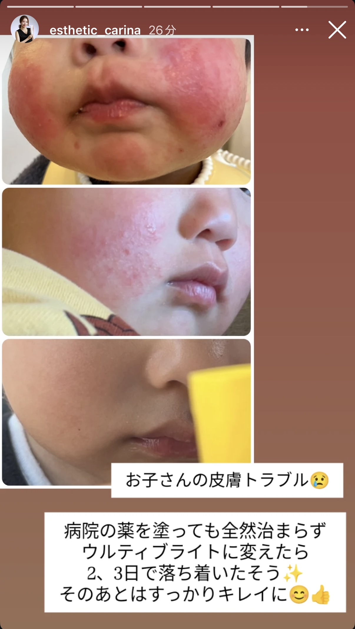 子供さんにもウルティブライト💕