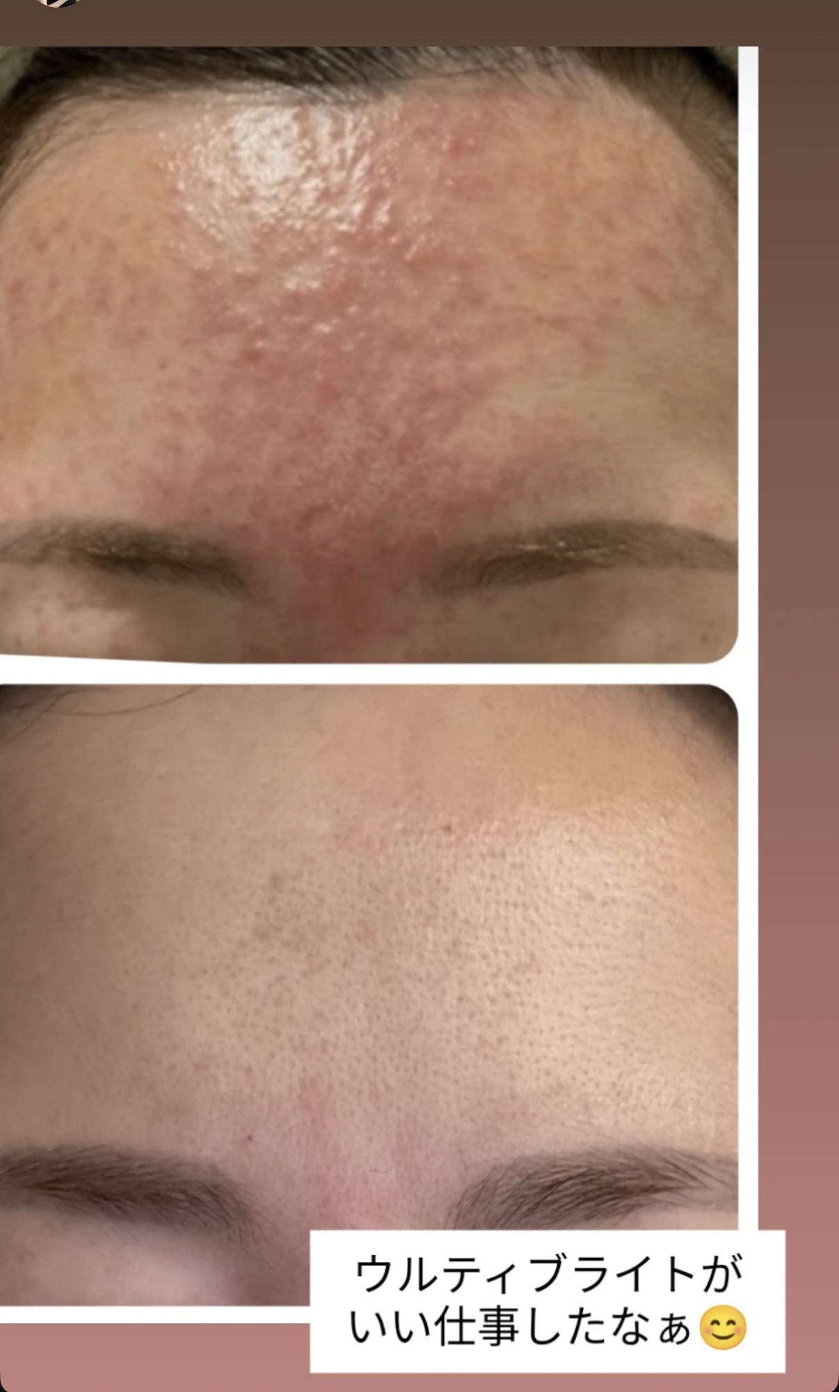 驚異のウルティブライト🩷