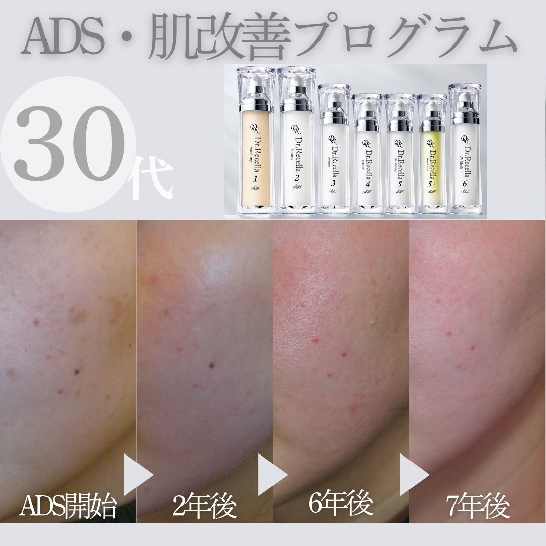 ノーファンデーションを本気で目指す方への最強プログラム✨