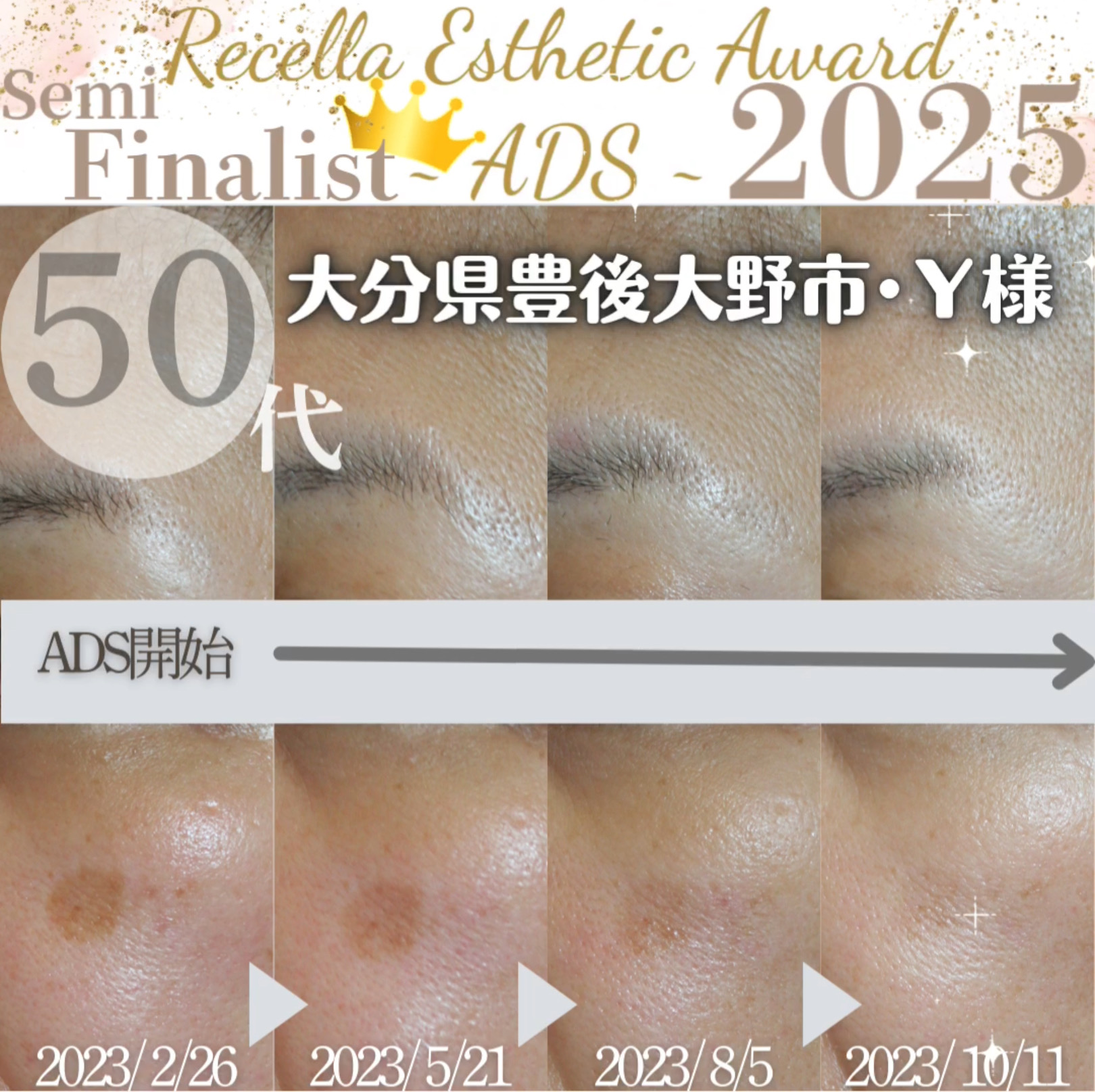 Recella Esthetic Award 2025『セミファイナリスト』受賞👑
