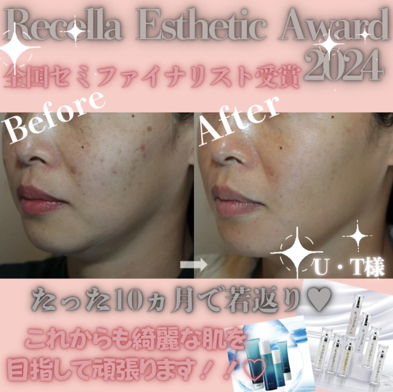 『Recella Esthetic Award 2024』