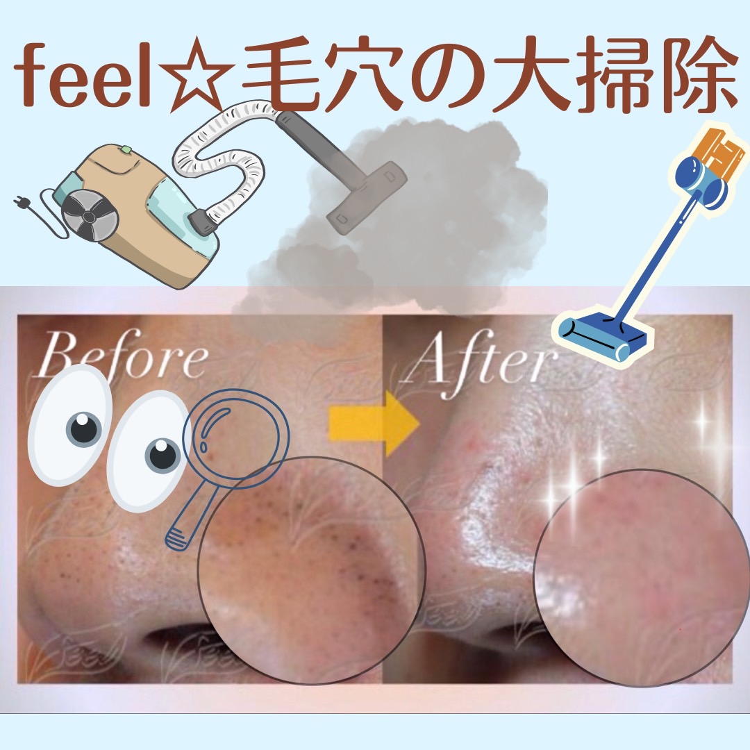 feelのフェイシャルエステ