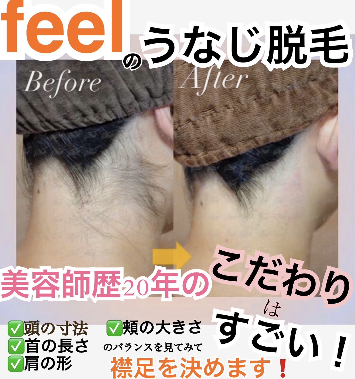 うなじ･襟足脱毛