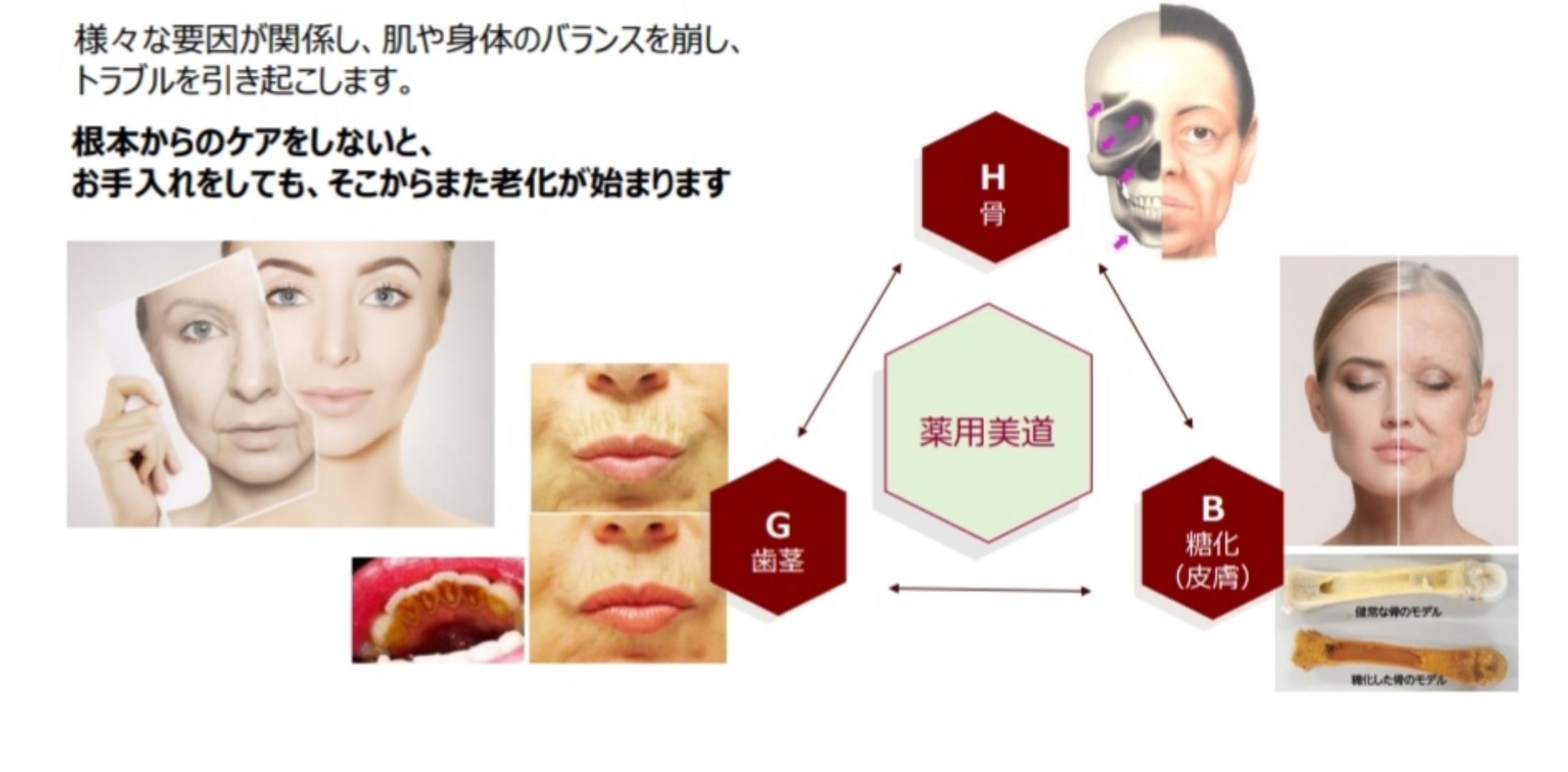 健康と美しさは糖化、骨、歯茎のケアから