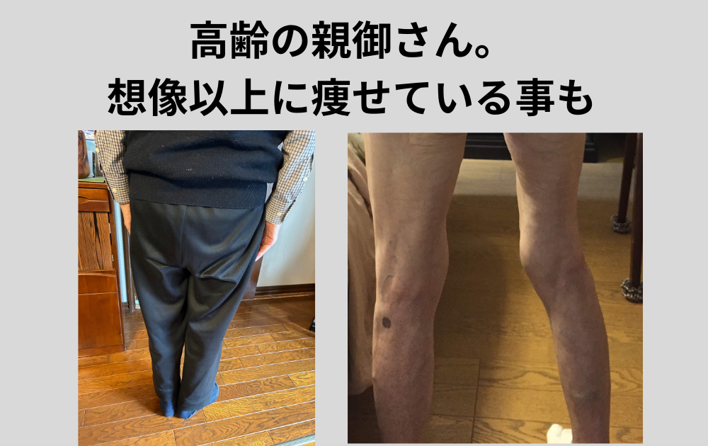お正月。高齢の親御さんの身体、ぜひ見て下さい