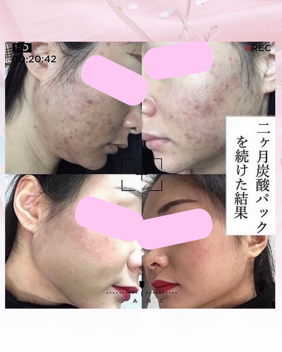 肌がきれいと褒められるようになりました☆