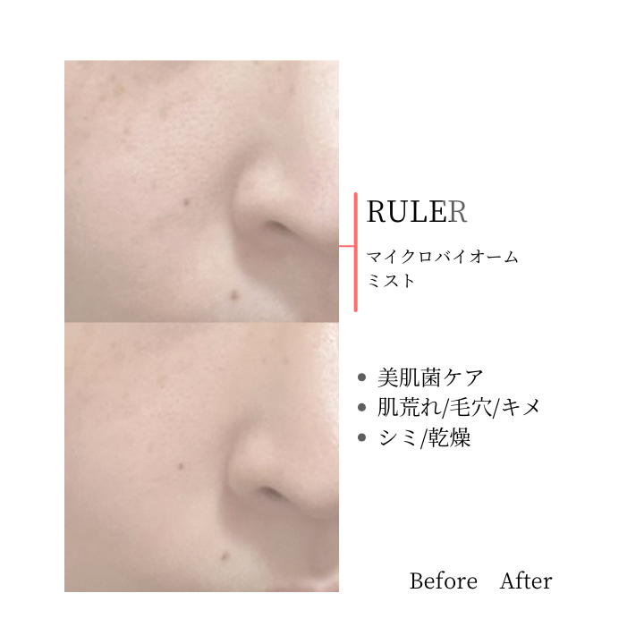 RULER マイクロバイオームミスト｜Before  After