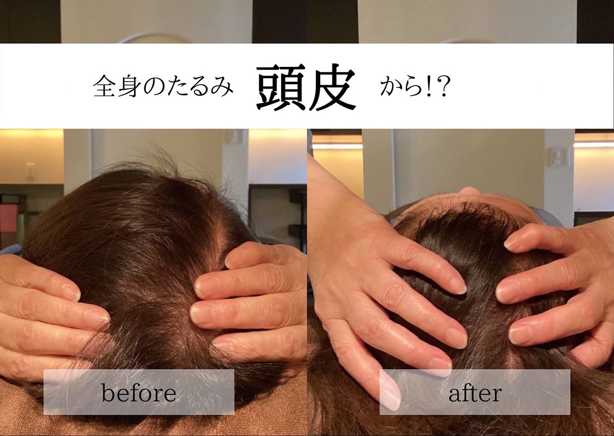 頭が軽い＝全身軽い