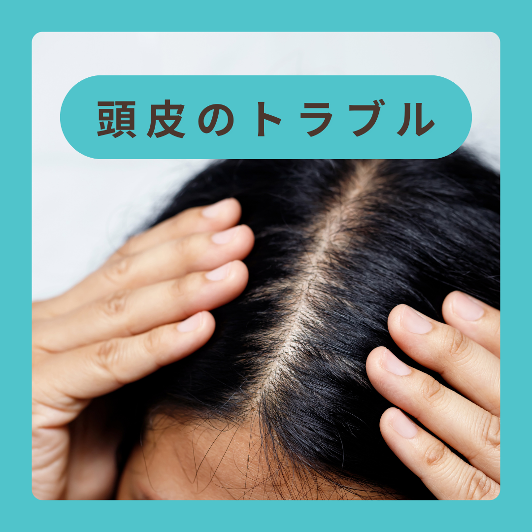 頭皮のトラブル
