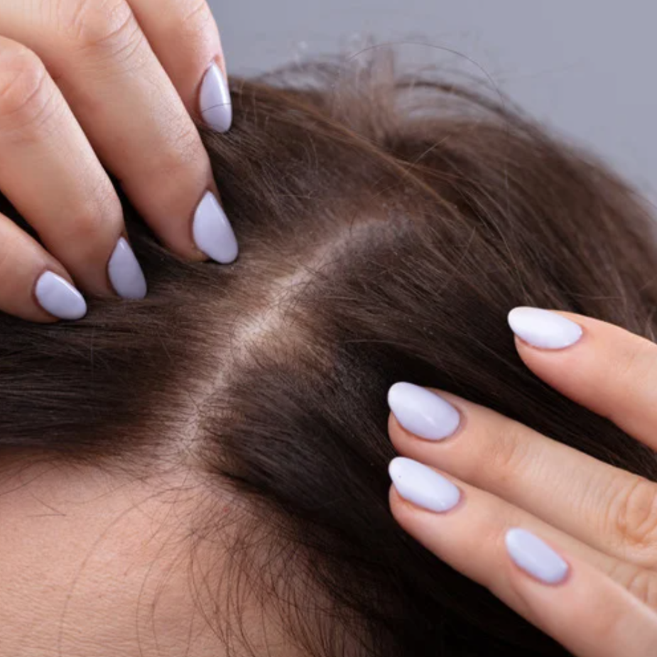 髪の分け目を毎日変えるだけで、薄毛予防に！？