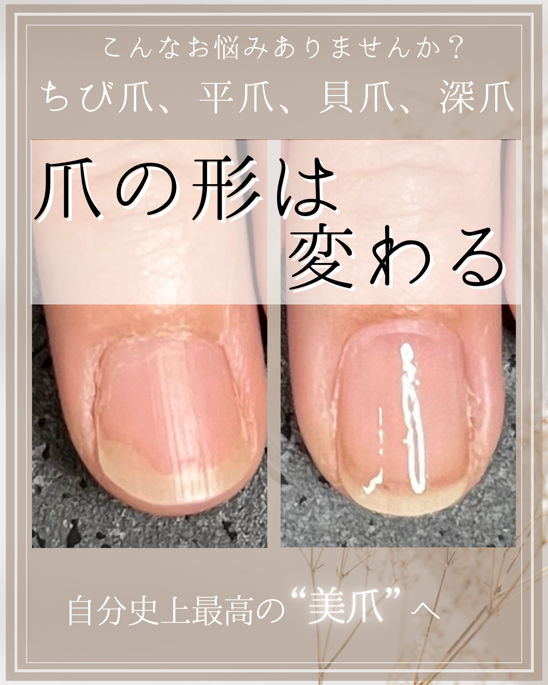 爪の形は変わる