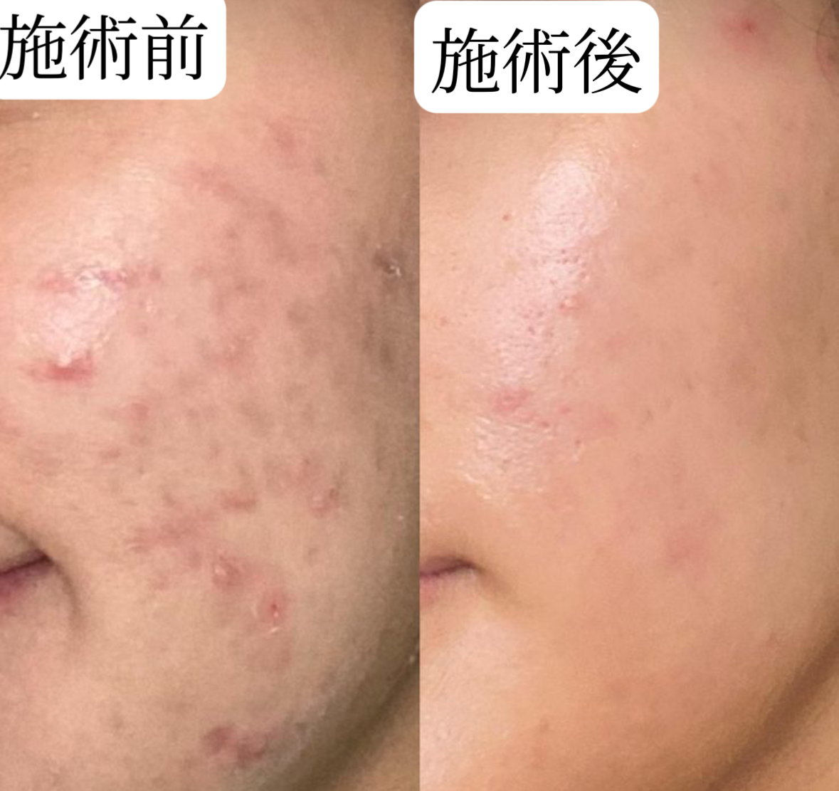 【肌悩みに終止符】リピート率90%以上の実力派サロンが選んだ！ドクターズコスメ「クリスティーナ」