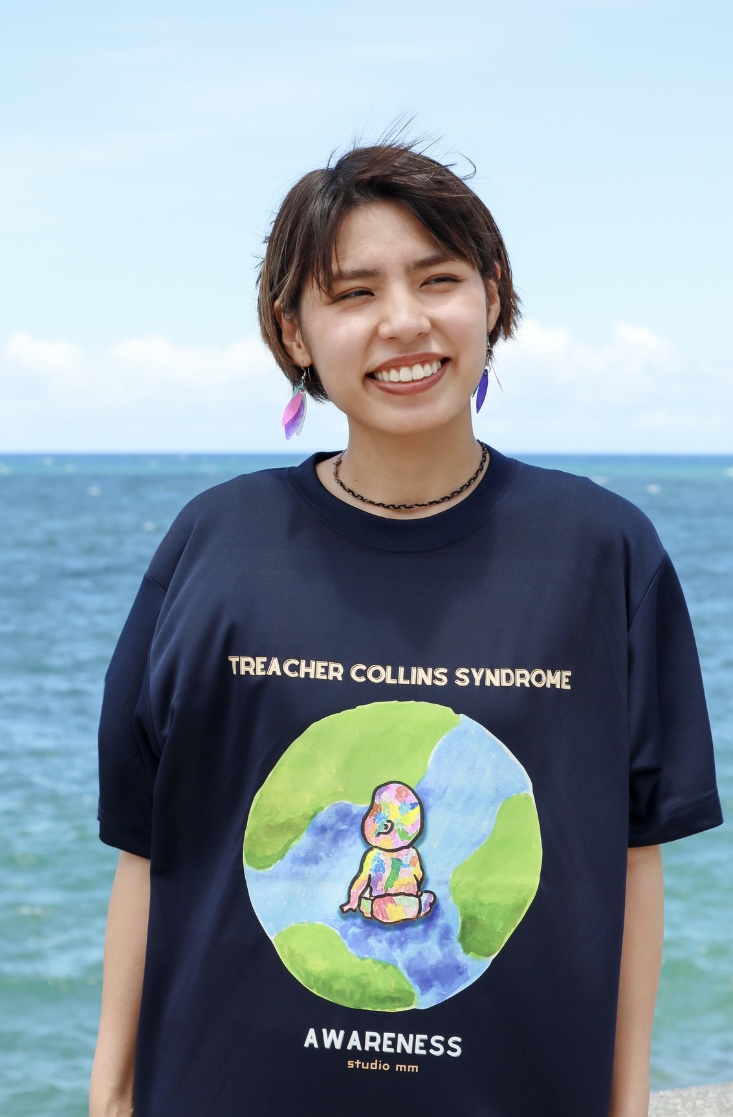 トリーチャーコリンズ症候群🌏