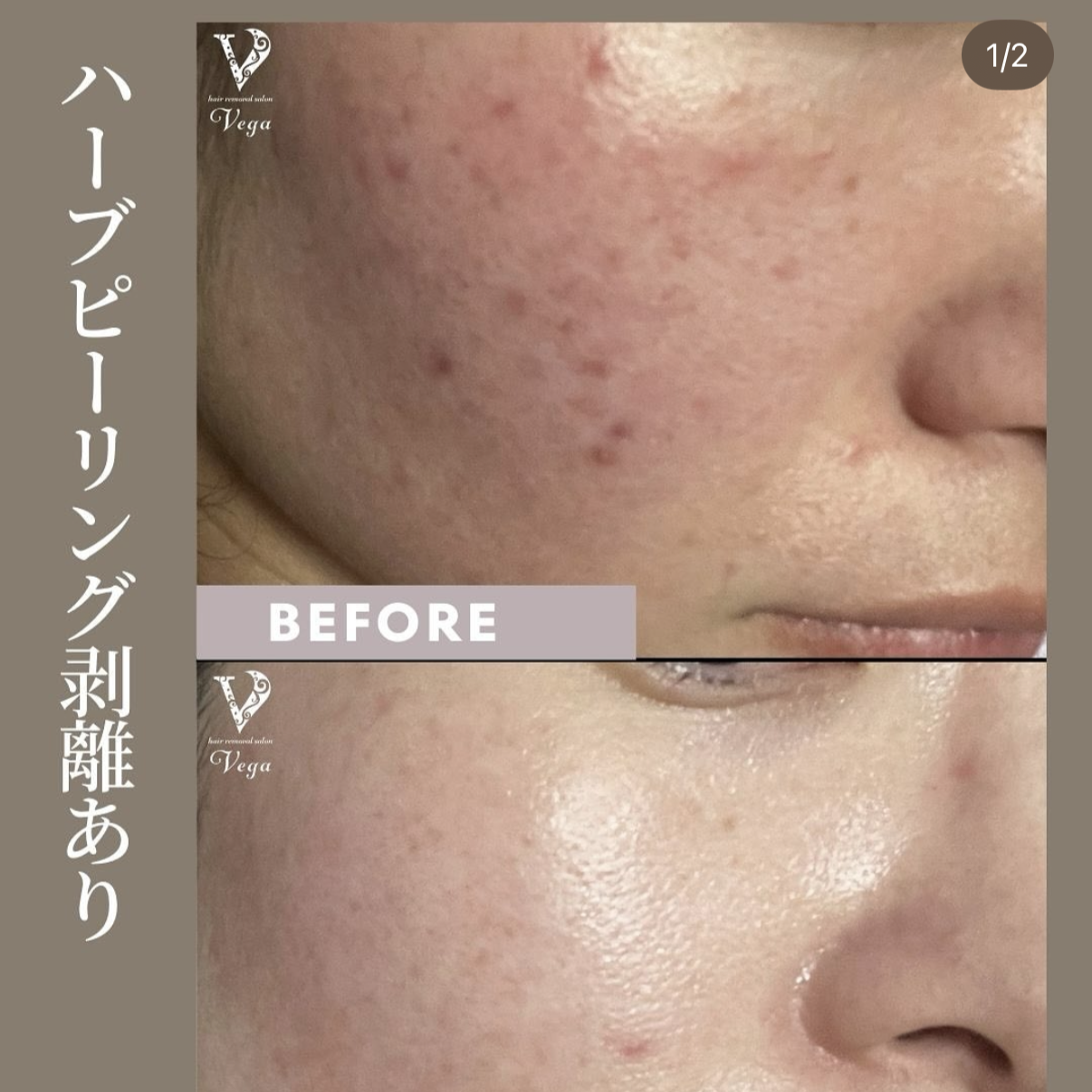 【サロン経営者様へ】高額マシン不要。ハンド技術と「商材力」だけで客単価を5,000円アップさせる方法