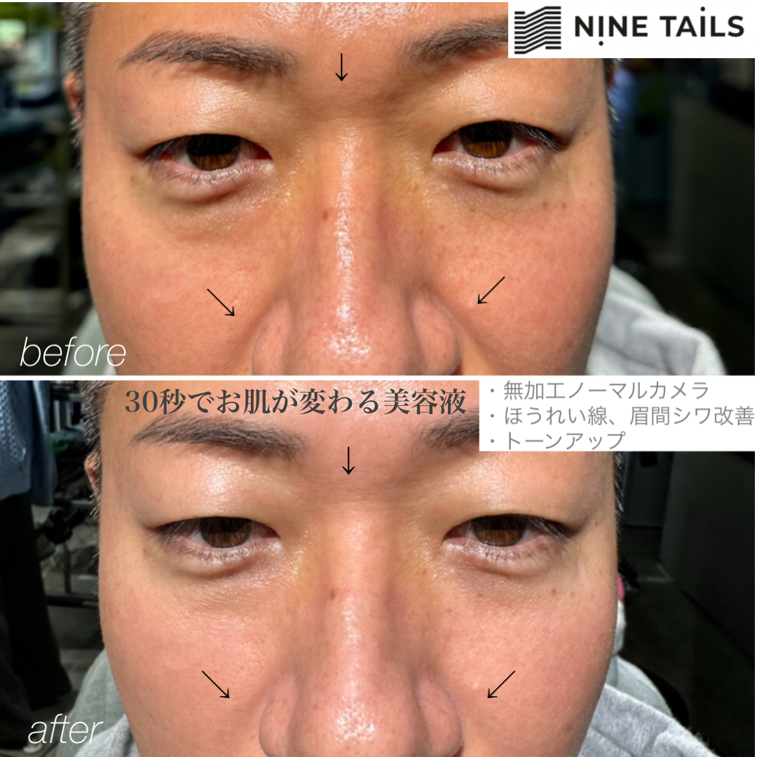 Before/After 90秒 men's