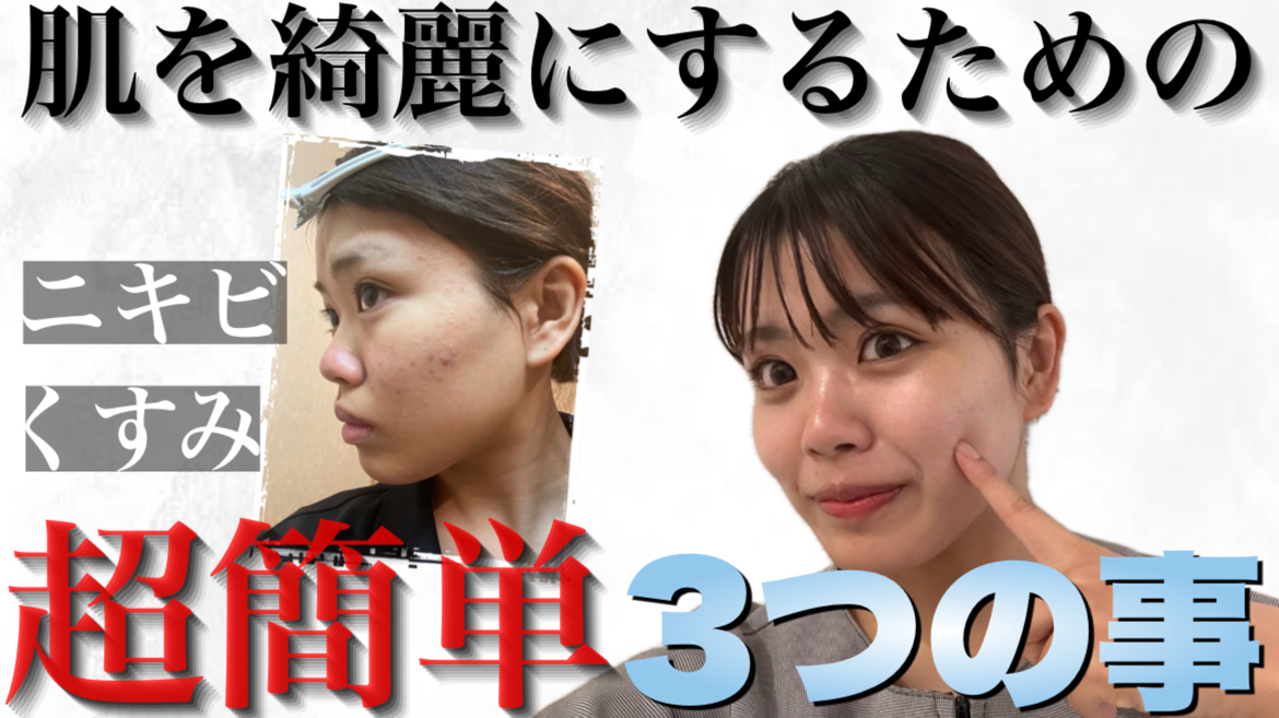【ニキビ改善】20代エステティシャンのリアル！肌トラブルだらけだった私がしたこと【ドクターリセラ】