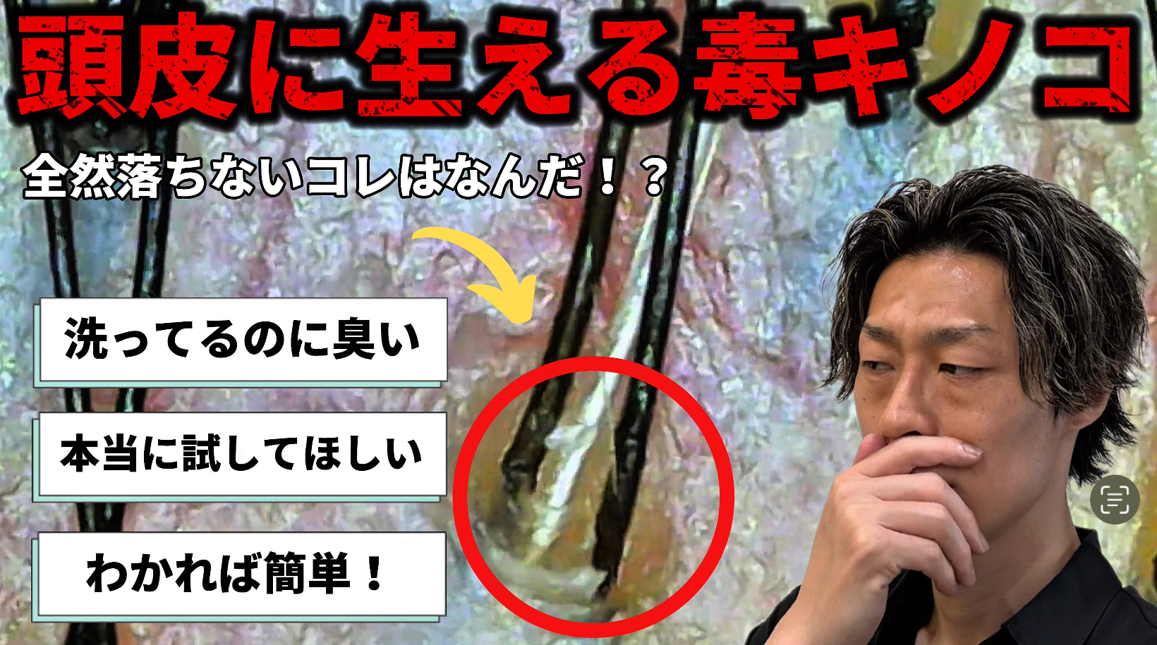 頭皮に生える毒キノコの正体とは？洗っても臭い原因はコレ！簡単に落とす方法を解説！